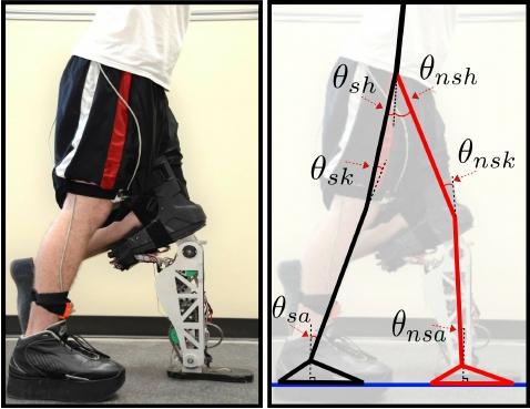 Manusia Setengah Robot